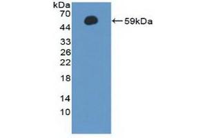 Detection of Recombinant CCNA1, Human using Polyclonal Antibody to Cyclin A1 (CCNA1) (Cyclin A1 antibody  (AA 183-430))