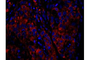 Immunofluorescence (IF) image for anti-Ribosomal Protein S6 (RPS6) (C-Term) antibody (ABIN7449016)