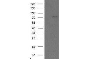 Image no. 1 for anti-SKI-Like Oncogene (SKIL) (AA 307-684) antibody (ABIN1491385) (SKIL antibody  (AA 307-684))