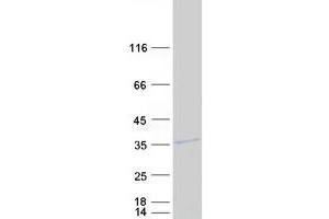 MARCH8 Protein (Transcript Variant 6) (Myc-DYKDDDDK Tag)