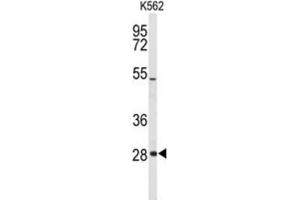 Western Blotting (WB) image for anti-Claudin 18 (CLDN18) (AA 231-259) antibody (ABIN3004093) (Claudin 18 antibody  (AA 231-259))