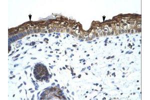 Image no. 1 for anti-SWI/SNF Related, Matrix Associated, Actin Dependent Regulator of Chromatin, Subfamily A, Member 2 (SMARCA2) (AA 58-107) antibody (ABIN6736031) (SMARCA2 antibody  (AA 58-107))