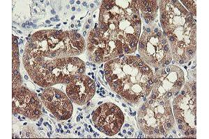 Immunohistochemical staining of paraffin-embedded Human Kidney tissue using anti-FTCD mouse monoclonal antibody. (FTCD antibody)