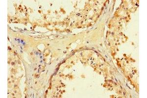 Immunohistochemistry of paraffin-embedded human testis tissue using ABIN7171480 at dilution of 1:100 (WRB antibody  (AA 38-99))
