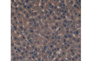 Used in DAB staining on fromalin fixed paraffin- embedded Kidney tissue (EIF2D antibody  (AA 360-570))