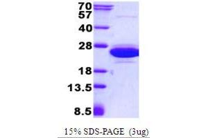 Image no. 1 for Cannabinoid Receptor Interacting Protein 1 (Cnrip1) protein (His tag) (ABIN1098392) (Cnrip1 Protein (His tag))