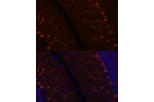 Immunofluorescence analysis of rat brain using K antibody (ABIN7268068) at dilution of 1:100. (KAL1 antibody  (AA 200-300))