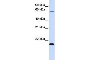 WB Suggested Anti-FAM19A3 Antibody Titration:  0.