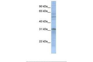 Image no. 1 for anti-Mitochondrial Carrier 2 (MTCH2) (N-Term) antibody (ABIN6739044)