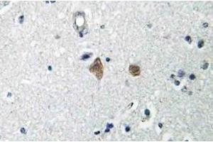 Immunohistochemistry (IHC) analyzes of mTOR antibody in paraffin-embedded human brain tissue. (MTOR antibody  (pSer2448))