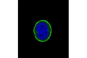 Confocal immunofluorescent analysis of IL10RA Antibody (Center) (ABIN652714 and ABIN2842473) with MCF-7 cell followed by Alexa Fluor® 488-conjugated goat anti-rabbit lgG (green). (IL-10RA antibody  (AA 147-175))