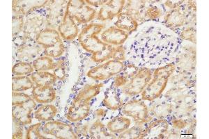 Formalin-fixed and paraffin embedded rat kidney labeled with Rabbit Anti-CD11b/c Polyclonal Antibody, Unconjugated  at 1:200 followed by conjugation to the secondary antibody and DAB staining (CD11b antibody  (AA 520-570))