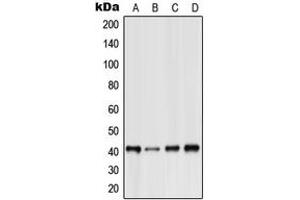 Western blot analysis of GPR15 expression in HeLa (A), Raw264. (GPR15 antibody  (Center))