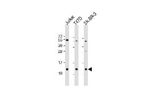 Western Blot at 1:2000 dilution Lane 1: Jurkat whole cell lysate Lane 2: T47D whole cell lysate Lane 3: SK-BR-3 whole cell lysate Lysates/proteins at 20 ug per lane. (TFF1 antibody  (AA 11-40))