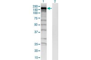 Western Blot analysis of SKIV2L expression in transfected 293T cell line by SKIV2L monoclonal antibody (M05), clone 1E5. (SKIV2L antibody  (AA 1125-1233))