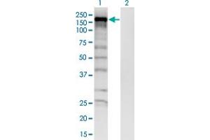 Western Blot analysis of SKIV2L expression in transfected 293T cell line by SKIV2L monoclonal antibody (M05), clone 1E5.