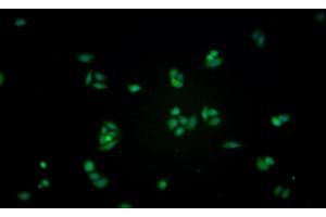Detection of GLa in Human MCF7 cell using Monoclonal Antibody to Galactosidase Alpha (GLa) (GLA antibody  (AA 81-429))