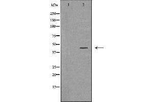 Western blot analysis of extracts of Y79, using ADIPOR1 antibody. (Adiponectin Receptor 1 antibody  (C-Term))