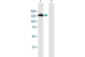 Western Blot analysis of BCR expression in transfected 293T cell line by BCR MaxPab polyclonal antibody. (BCR antibody  (AA 1-1076))