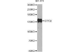 Western blot analysis of extracts of BT-474 cells, using GTF2I antibody (ABIN5995399) at 1/500 dilution. (GTF2I antibody)
