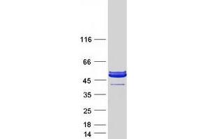 Western Blotting (WB) image for Parvin, alpha (PARVA) protein (Myc-DYKDDDDK Tag) (ABIN2728292)