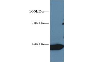 Detection of AST in Rat Cerebrum lysate using Monoclonal Antibody to Aspartate Aminotransferase (AST)