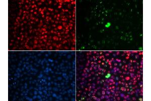 Immunofluorescence analysis of U2OS cells using Phospho-ATM-S1981 antibody (ABIN5969871). (ATM antibody  (pSer1981))