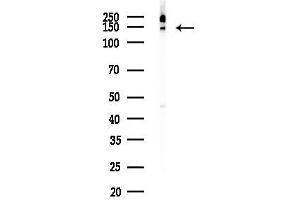 Western blot analysis of lysates from Rat brain, using BCL Antibody at 1/1000 dilution.