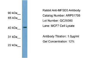 WB Suggested Anti-MFSD3  Antibody Titration: 0. (MFSD3 antibody  (Middle Region))