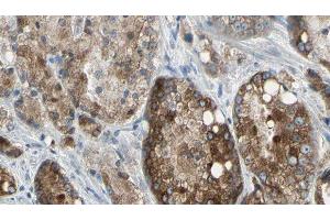ABIN6276838 at 1/100 staining Human prostate tissue by IHC-P. (TLR5 antibody  (C-Term))
