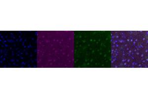 Immunohistochemistry (IHC) image for anti-Neural Cell Adhesion Molecule 1 (NCAM1) antibody (ABIN7456209)