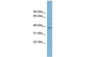 WB Suggested Anti-B3GALNT1 Antibody Titration:  0. (B3GALNT1 antibody  (Middle Region))