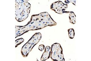IHC analysis of SNRNP200 using anti-SNRNP200 antibody (ABIN7602032). (SNRNP200 antibody  (AA 557-2129))