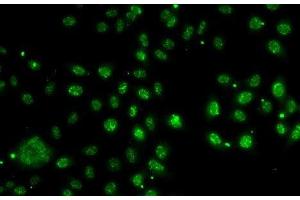 Immunofluorescence analysis of A-549 cells using LDLRAP1 Polyclonal Antibody (LDLRAP1 antibody)
