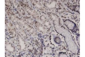 Immunoperoxidase of monoclonal antibody to PTK6 on formalin-fixed paraffin-embedded human stomach. (PTK6 antibody  (AA 342-451))