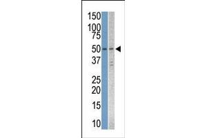 Image no. 1 for anti-serine/threonine Kinase 38 Like (STK38L) (C-Term) antibody (ABIN360006) (STK38L antibody  (C-Term))