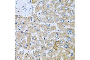 Immunohistochemistry of paraffin-embedded human liver injury using POMGNT1 antibody at dilution of 1:100 (x40 lens).
