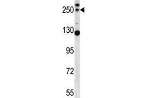 C4B antibody western blot analysis in mouse lung tissue lysate (C4B antibody  (AA 655-684))