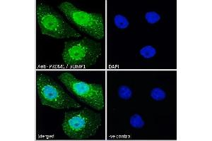 ABIN570911 Immunofluorescence analysis of paraformaldehyde fixed A431 cells, permeabilized with 0. (PRDM1 antibody  (C-Term))