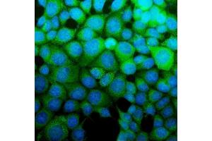 IF analysis of ASS1 using anti-ASS1 antibody (ABIN7601191). (ASS1 antibody  (AA 3-365))