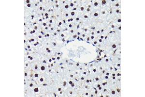 Immunohistochemistry of paraffin-embedded mouse liver using Phospho-Rb-S780 antibody (ABIN7269936) at dilution of 1:100 (40x lens). (Retinoblastoma 1 antibody  (pSer780))