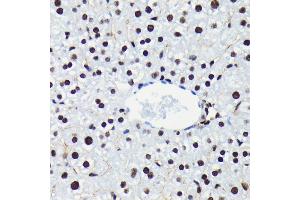Immunohistochemistry of paraffin-embedded mouse liver using Phospho-Rb-S780 antibody (ABIN7269936) at dilution of 1:100 (40x lens). (Retinoblastoma 1 antibody  (pSer780))