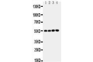 Anti-NRF1 antibody, Western blotting Lane 1: Rat Brain Tissue Lysate Lane 2: Rat Kidney Tissue Lysate Lane 3: MCF-7 Cell Lysate Lane 4: A549 Cell Lysate