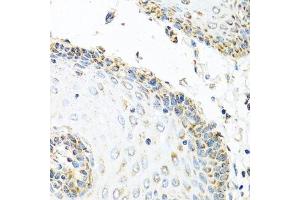 Immunohistochemistry of paraffin-embedded human esophagus using GNRH2 antibody. (GnRH2 antibody  (AA 24-120))