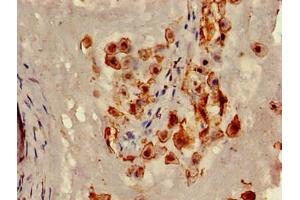 Immunohistochemistry (IHC) image for anti-Caveolin 2 (CAV2) (AA 3-64) antibody (ABIN7147067)