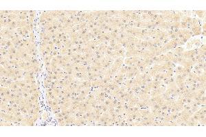 Detection of TRAF6 in Human Liver Tissue using Polyclonal Antibody to TNF Receptor Associated Factor 6 (TRAF6) (TRAF6 antibody  (AA 153-423))