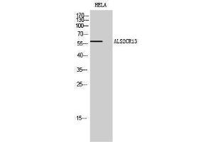 Western Blotting (WB) image for anti-Family with Sequence Similarity 117, Member B (FAM117B) (C-Term) antibody (ABIN3183258) (FAM117B antibody  (C-Term))