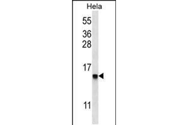 DEFB112 antibody  (N-Term)