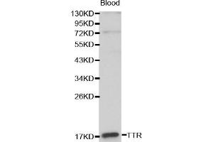 Western blot analysis of Blood cell lysate using TTR antibody. (TTR antibody  (AA 21-147))