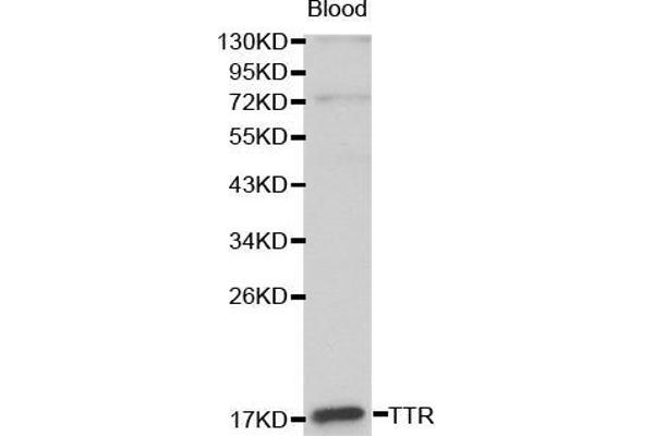 TTR anticorps  (AA 21-147)